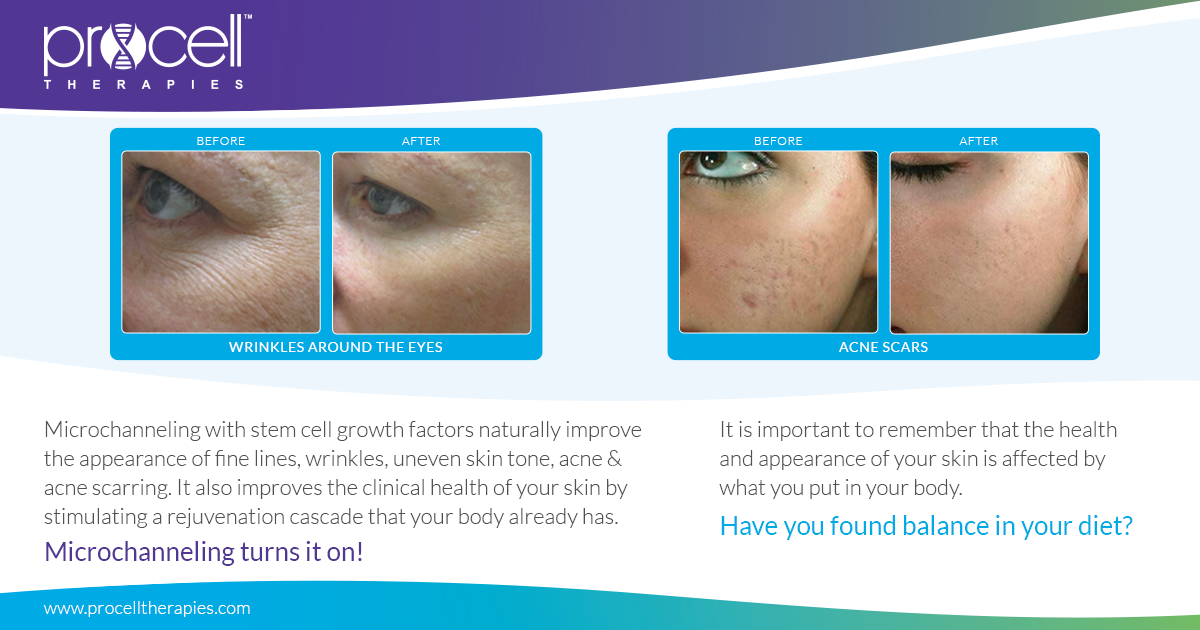 procell therapies near me