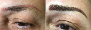 eyebrows
