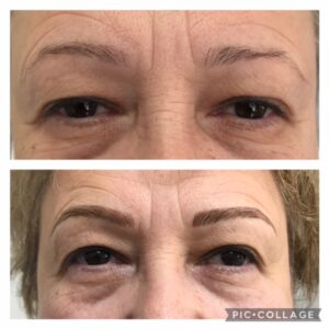 eyebrows