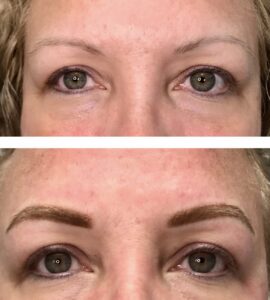 eyebrows