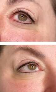 march-brows