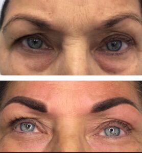 brows