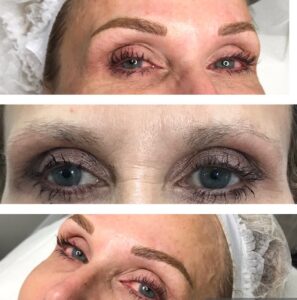 brows