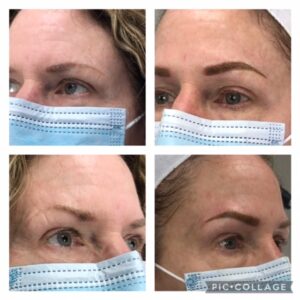 addon-brows