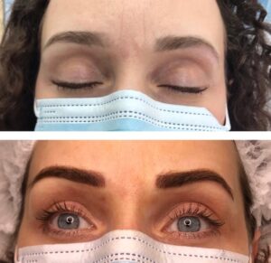 addon-brows