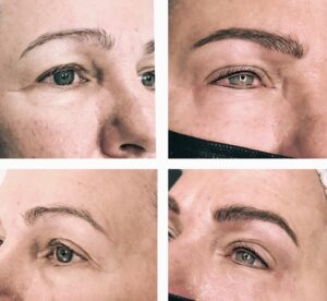 eyebrows