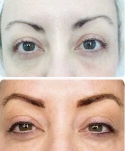 brows