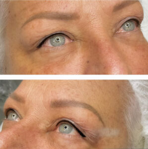 brows-oct