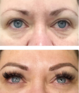 brows