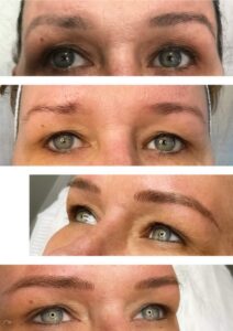 brows-oct