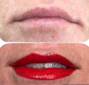lips