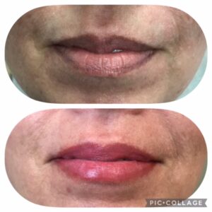lips