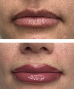 lips