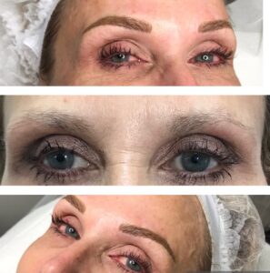 eyebrows