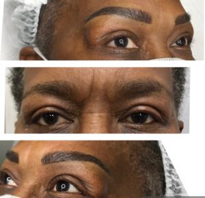 eyebrows