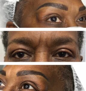 eyebrows